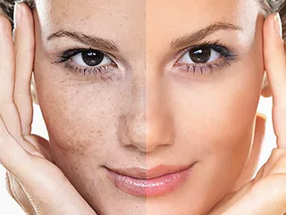 Pevonia Facial Offer